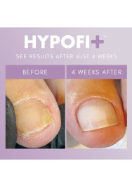HypoFix™ Repair Serum
